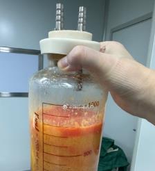 资兴水动力吸脂手术要做多久？